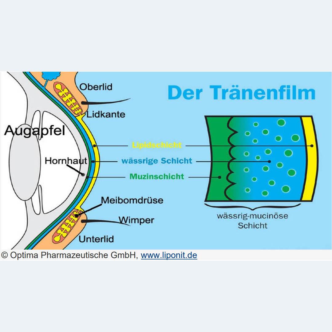 <h4>Trockene Augen</h4>